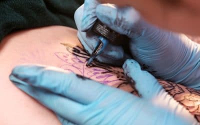 Cómo borrar tatuajes con láser
